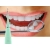 Skaler dentystyczny ultradźwiękowy do czyszczenia zębów usuwanie kamienia
